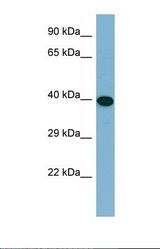 Western blot of Human HT1080. ERCC6L2 antibody dilution 1.0 ug/ml.
