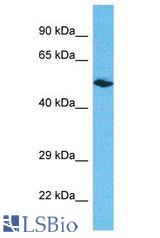 ERCC6L2 antibody Western Blot of Breast Tumor. Antibody dilution: 1 ug/ml.