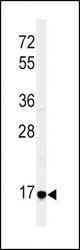 Western blot of EREG Antibody in HepG2 cell line lysates (35 ug/lane). EREG (arrow) was detected using the purified antibody.