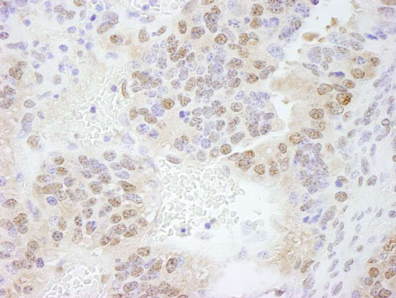 Detection of Mouse ERF by Immunohistochemistry. Sample: FFPE section of mouse teratoma. Antibody: Affinity purified rabbit anti-ERF used at a dilution of 1:500.