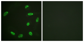 Immunofluorescence of HeLa cells, using ERF (Ab-526) Antibody. The picture on the right is treated with the synthesized peptide.