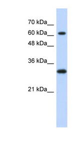 ERF / PE-2 antibody LS-C101381 Western blot of Transfected 293T cell lysate.