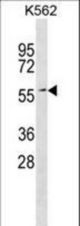 ERF Antibody western blot of K562 cell line lysates (35 ug/lane). The ERF antibody detected the ERF protein (arrow).