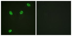Immunofluorescence of HeLa cells, using ERF (Phospho-Thr526) Antibody. The sample on the right was incubated with synthetic peptide.