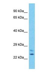 Western blot of CHMP6 Antibody with human Jurkat Whole Cell lysate.