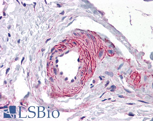 Anti-ERG antibody IHC of human vessel. Immunohistochemistry of formalin-fixed, paraffin-embedded tissue after heat-induced antigen retrieval. Antibody LS-B4864 concentration 10 ug/ml.