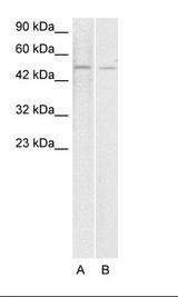 A. Jurkat Cell Lysate B. HepG2 Cell Lysate