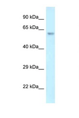 ERG antibody LS-C145716 Western blot of Mouse Pancreas lysate. Antibody concentration 1 ug/ml.