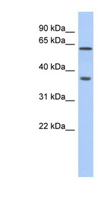 ERG antibody LS-C102731 Western blot of Fetal Liver lysate.