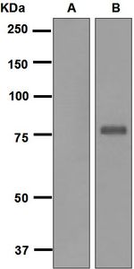 Western blot analysis on (A) 10 ng of Fli1 recombinant protein and (B) 10 ng of ERG recombinant protein lysates using anti-ERG antibody.