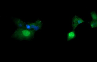 Anti-ERG mouse monoclonal antibody immunofluorescent staining of COS7 cells transiently transfected by pCMV6-ENTRY ERG.