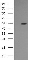 HEK293T cells were transfected with the pCMV6-ENTRY control (Left lane) or pCMV6-ENTRY ERG (Right lane) cDNA for 48 hrs and lysed. Equivalent amounts of cell lysates (5 ug per lane) were separated by SDS-PAGE and immunoblotted with anti-ERG.