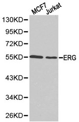 Western blot of ERG pAb in extracts from MCF7 and Jurkat cells.