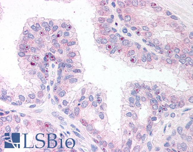 Anti-ERG antibody IHC of human prostate. Immunohistochemistry of formalin-fixed, paraffin-embedded tissue after heat-induced antigen retrieval. Antibody LS-B9 concentration 10 ug/ml.