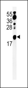 Western blot of ZNF9 Antibody in Neuro-2a cell line lysates (35 ug/lane). ZNF9 (arrow) was detected using the purified antibody.