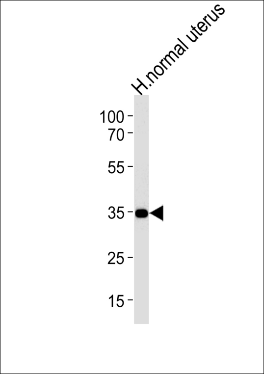 CUZD1 Antibody western blot of human normal uterus tissue lysates (35 ug/lane). The CUZD1 antibody detected the CUZD1 protein (arrow).