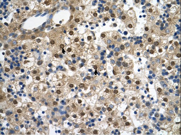 SQLE antibody LS-C80481 was used in IHC to stain formalin-fixed, paraffin-embedded human liver.