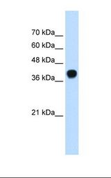 721_B cell lysate. Antibody concentration: 0.25 ug/ml. Gel concentration: 12%.