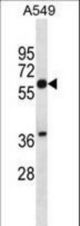 SQLE Antibody western blot of A549 cell line lysates (35 ug/lane). The SQLE antibody detected the SQLE protein (arrow).
