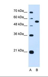 Lane A: Marker. Lane B: HepG2 cell lysate. Antibody concentration: 1.25 ug/ml. Gel concentration: 12%.