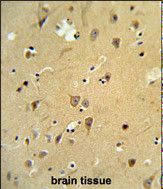 Formalin-fixed and paraffin-embedded human brain tissue reacted with LMAN1 Antibody (Center), which was peroxidase-conjugated to the secondary antibody, followed by DAB staining.