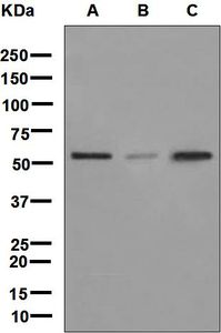 Western blot analysis on (A) HeLa, (B) NCI-H460, and (C) JAR cell lysates using anti-LMAN1 antibody.