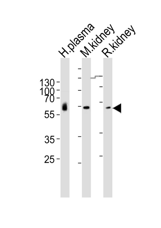 Western blot of lysates from human plasma, mouse kidney, rat kidney tissue lysate (from left to right) with CNDP1 Antibody. Antibody was diluted at 1:1000 at each lane. A goat anti-rabbit IgG H&L (HRP) at 1:10000 dilution was used as the secondary antibody. Lysates at 20 ug per lane.