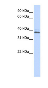 ERGIC2 antibody LS-C101741 Western blot of Jurkat lysate.