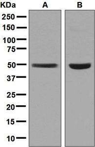 Western blot analysis on (A) MCF-7 and (B) Caco-2 cell lysates using anti-ERGIC3 antibody.
