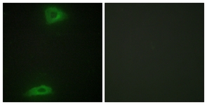 Immunofluorescence of HepG2 cells, using ERGI3 Antibody. The picture on the right is treated with the synthesized peptide.
