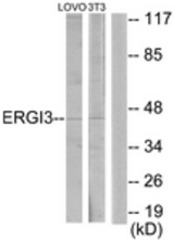 Western blot of extracts from LOVO/NIH-3T3 cells, using ERGI3 Antibody. The lane on the right is treated with the synthesized peptide.