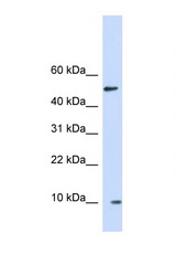 ERH antibody LS-C146097 Western blot of Fetal Brain lysate. Antibody concentration 1 ug/ml.