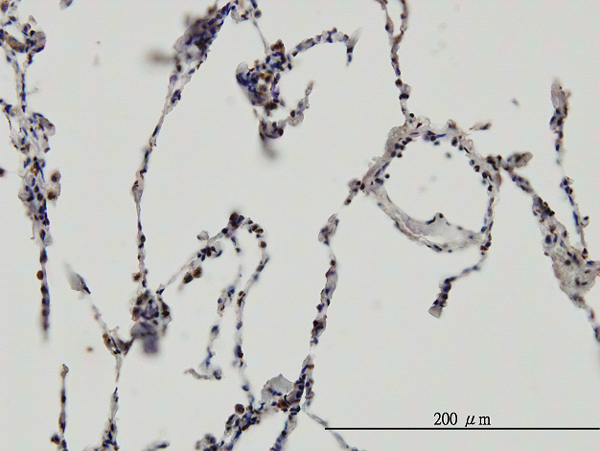 Immunoperoxidase of monoclonal antibody to ERH on formalin-fixed paraffin-embedded human lung. [antibody concentration 3 ug/ml]
