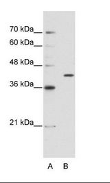 B: HepG2 Cell Lysate