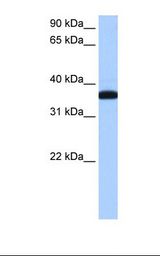 MCF7 cell lysate. Antibody concentration: 0.5 ug/ml. Gel concentration: 12%.