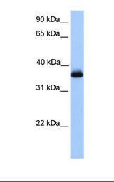 Jurkat cell lysate. Antibody concentration: 1.0 ug/ml. Gel concentration: 12%.