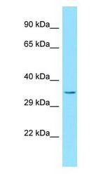 ERI3 antibody Western Blot of 721_B.