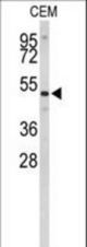 Western blot of CNDP1 Antibody in CEM cell line lysates (35 ug/lane). CNDP1 (arrow) was detected using the purified antibody.