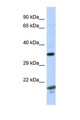 CHN1 antibody LS-C145645 Western blot of Fetal Thymus lysate. Antibody concentration 1 ug/ml.