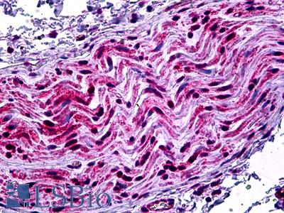 Anti-ERK1/2-T202/Y204 antibody IHC of human prostate, nerve. Immunohistochemistry of formalin-fixed, paraffin-embedded tissue after heat-induced antigen retrieval. Antibody LS-C97127 concentration 5 ug/ml.