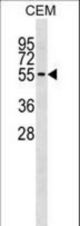 ERMAP Antibody western blot of CEM cell line lysates (35 ug/lane). The ERMAP antibody detected the ERMAP protein (arrow).