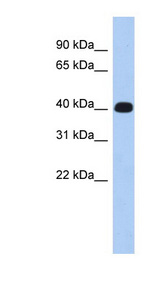 ERMN / KIAA1189 antibody LS-C111833 Western blot of Fetal Muscle lysate.