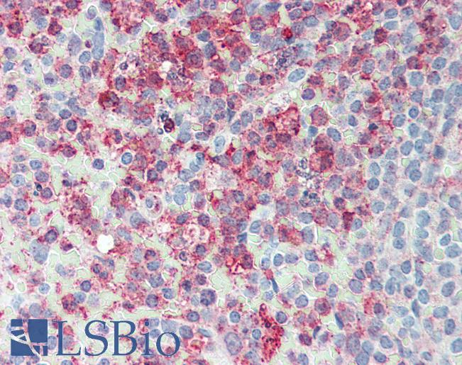 Anti-ERMP1 antibody LS-A9254 IHC of human spleen. Immunohistochemistry of formalin-fixed, paraffin-embedded tissue after heat-induced antigen retrieval.
