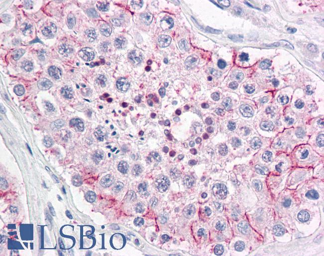 Anti-ERMP1 antibody LS-A9255 IHC of human testis. Immunohistochemistry of formalin-fixed, paraffin-embedded tissue after heat-induced antigen retrieval.