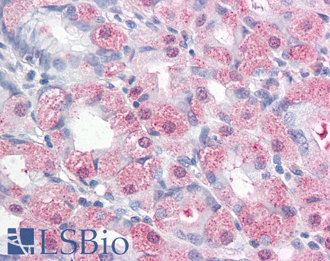 Anti-ERMP1 antibody LS-A9255 IHC of human stomach. Immunohistochemistry of formalin-fixed, paraffin-embedded tissue after heat-induced antigen retrieval.