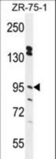 ERMP1 Antibody western blot of ZR-75-1 cell line lysates (35 ug/lane). The ERMP1 antibody detected the ERMP1 protein (arrow).