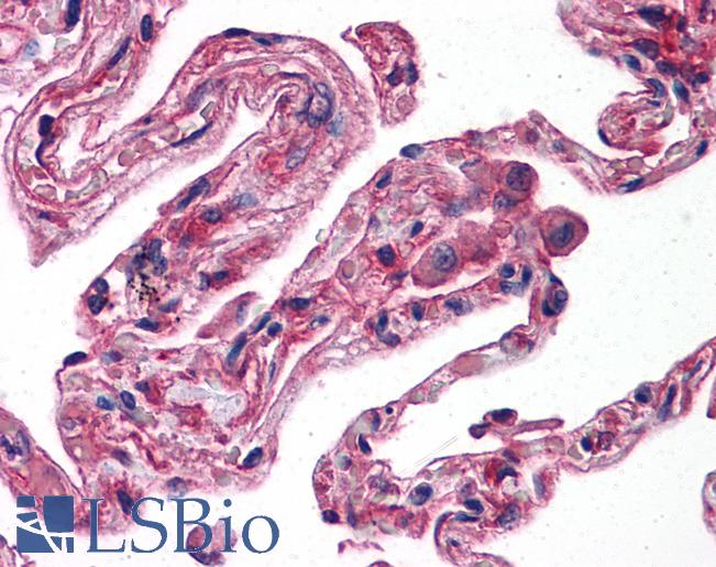 Anti-ERN1 / IRE1 antibody IHC of human lung. Immunohistochemistry of formalin-fixed, paraffin-embedded tissue after heat-induced antigen retrieval. Antibody LS-B4154 dilution 1:200.