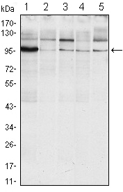Western blot using ERN1 mouse monoclonal antibody against Raji (1), A431 (2), Jurkat (3), HeLa(4) and HEK293 (5) cell lysate.