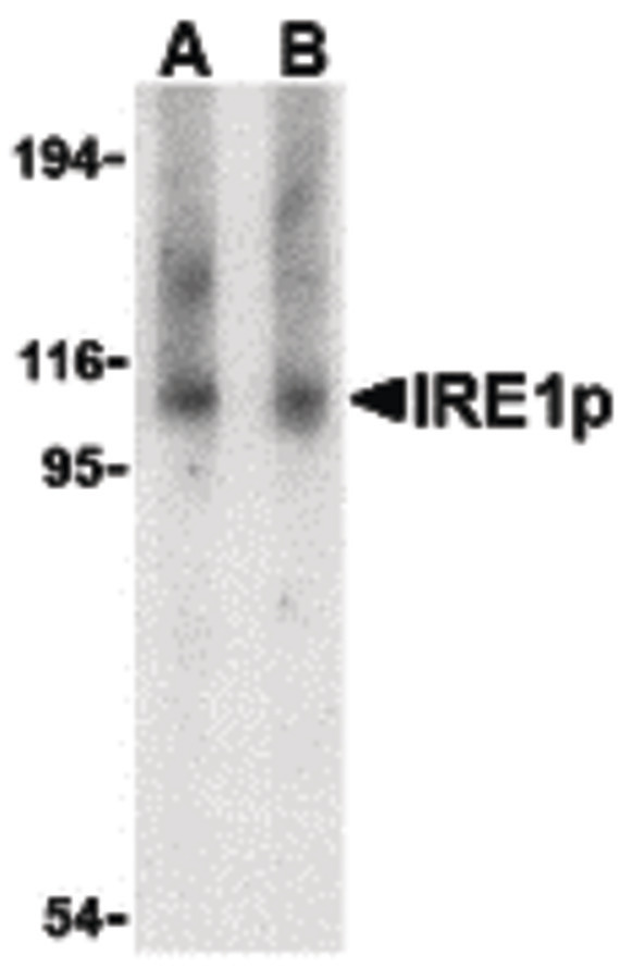 Western blot of IRE1p in Raji cell lysate with IRE1p antibody at (A) 1 and (B) 2 ug/ml.