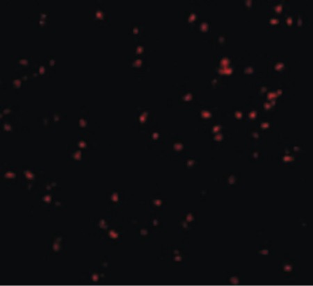 Immunofluorescence of IRE1p in A20 cells with IRE1p antibody at 10 ug/ml.